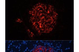 Immunofluorescence analysis of Rat pancreas using INS Polyclonal Antibody at dilution of 1:100. (Insulin 抗体)
