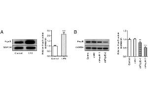 Fxyd5 silencing enhances cell viability and inhibits cell apoptosis and ECM degradation in ATDC5 cells. (FXYD5 抗体  (N-Term))