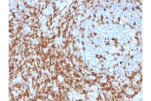 Formalin-fixed, paraffin-embedded human Tonsil stained with CD5 Mouse Monoclonal Antibody (CD5/2419). (CD5 抗体  (AA 269-366))