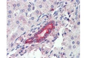 IHC testing of FFPE human liver tissue with ROR1 antibody at 3ug/ml. (ROR1 抗体)