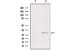 Western blot analysis of extracts from Hela, using ASAH3 Antibody. (ACER1 抗体  (Internal Region))