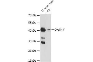 Western blot analysis of extracts of various cell lines, using Cyclin Y antibody (ABIN7266575) at 1:1000 dilution. (Cyclin Y 抗体  (AA 60-120))