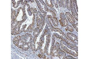 IHC analysis of GLUD1/2 using anti-GLUD1/2 antibody (ABIN7602000). (GLUD1 / GLUD2 (AA 54-553) 抗体)
