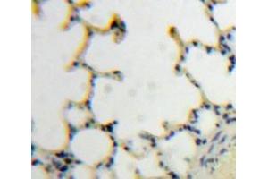 #VALUE! (TLR7 抗体  (AA 890-1037))