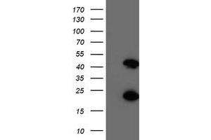 Western Blotting (WB) image for anti-Centromere Protein H (CENPH) antibody (ABIN1497473) (CENPH 抗体)