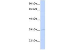 Image no. 1 for anti-Solute Carrier Family 25 (Mitochondrial Carrier, Adenine Nucleotide Translocator), Member 6 (SLC25A6) (AA 36-85) antibody (ABIN6741462)