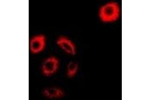 Immunofluorescent analysis of AMPK beta 2 staining in MCF7 cells. (PRKAB2 抗体)