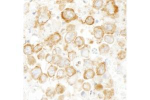 Immunohistochemistry (IHC) image for anti-Cytoskeleton-Associated Protein 4 (CKAP4) (AA 500-550) antibody (ABIN7448940) (CKAP4 抗体  (AA 500-550))