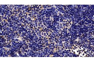 Detection of TLR5 in Rat Lymph node Tissue using Polyclonal Antibody to Toll Like Receptor 5 (TLR5) (TLR5 抗体  (AA 303-514))