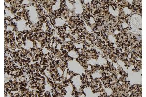 Immunohistochemistry (IHC) image for anti-Protein Phosphatase 1, Regulatory Subunit 9B, Spinophilin (PPP1R9B) (C-Term) antibody (ABIN6263578)