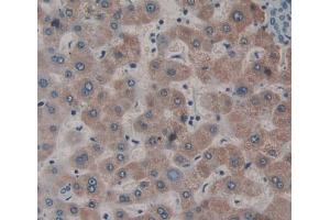 IHC-P analysis of liver tissue, with DAB staining. (Dystonin 抗体  (AA 1-252))