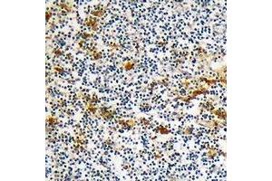 Immunohistochemical analysis of DOK6 staining in human lymph node formalin fixed paraffin embedded tissue section. (DOK6 抗体)