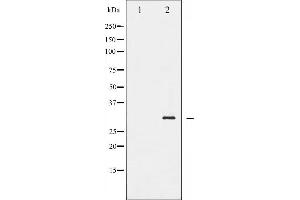 Western blot analysis of BCL-2 phosphorylation expression in LPS treated HeLa whole cell lysates,The lane on the left is treated with the antigen-specific peptide. (Bcl-2 抗体  (pSer70))