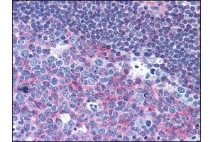 Immunohistochemistry (IHC) image for anti-CD40 (CD40) antibody (ABIN400699) (CD40 抗体)