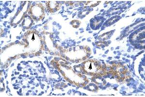 Human kidney; ZA20D3 antibody - middle region in Human kidney cells using Immunohistochemistry (ZFAND6 抗体  (Middle Region))