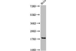 Western Blot Positive WB detected in: Hela whole cell lysate All lanes: RPS15 antibody at 4 μg/mL Secondary Goat polyclonal to rabbit IgG at 1/50000 dilution Predicted band size: 18 kDa Observed band size: 18 kDa (RPS15 抗体  (AA 63-137))