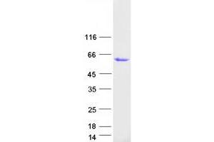 Validation with Western Blot