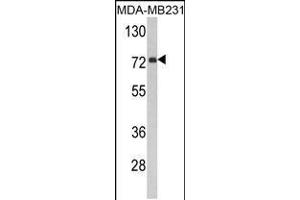 Western blot analysis of FMO3 Antibody in MDA-MB231 cell line lysates (35ug/lane) (FMO3 抗体  (N-Term))
