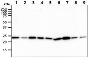 The cell lysates (40ug) were resolved by SDS-PAGE, transferred to PVDF membrane and probed with anti-human CINP antibody (1:1000). (CINP 抗体)