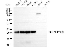 Western blotting analysis using NUP62CL antibody (ABIN7799680).