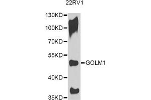Western blot analysis of extracts of 22RV1 cells, using GOLM1 antibody. (GOLM1 抗体)