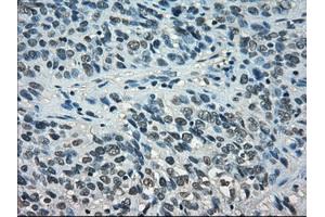 Immunohistochemistry (IHC) image for anti-Signal Transducer and Activator of Transcription 1, 91kDa (STAT1) antibody (ABIN1501168) (STAT1 抗体)