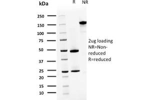 SDS-PAGE Analysis Purified S100A4 Mouse Monoclonal Antibody (CPTC-S100A4-3). (s100a4 抗体)