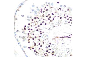 Immunohistochemistry (IHC) image for anti-Chromobox Homolog 5 (CBX5) antibody (ABIN1678748)