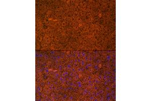 anti-Phenylalanine Hydroxylase antibody