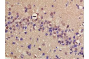 Formalin-fixed and paraffin embedded rat brain labeled with Rabbit Anti-ERCC8/CSA Polyclonal Antibody, Unconjugated (ABIN1713778) at 1:200 followed by conjugation to the secondary antibody and DAB staining