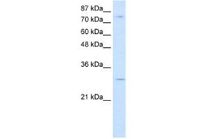 WB Suggested Anti-RBM28 Antibody Titration:  0. (RBM28 抗体  (C-Term))