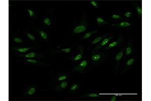 Immunofluorescence of purified MaxPab antibody to ZCCHC9 on HeLa cell. (ZCCHC9 抗体  (AA 1-271))