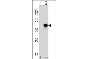 Western blot analysis of DFFA (arrow) using rabbit polyclonal DFFA Antibody (C-term) (ABIN653234 and ABIN2842766).