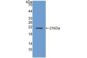 Detection of Recombinant UBE2L3, Human using Polyclonal Antibody to Ubiquitin Conjugating Enzyme E2L3 (UBE2L3) (UBE2L3 抗体  (AA 4-154))