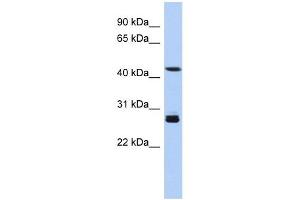 SYT9 antibody used at 1 ug/ml to detect target protein. (SYT9 抗体  (Middle Region))