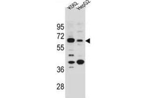 Western Blotting (WB) image for anti-Na+/H+ Exchanger Domain Containing 1 (NHEDC1) antibody (ABIN2996071) (NHEDC1 抗体)
