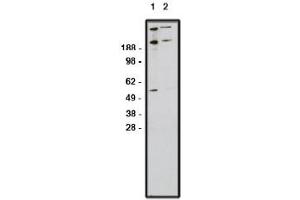 Image no. 1 for anti-Zinc Finger Protein GLI1 (GLI1) antibody (ABIN4620372) (GLI1 抗体)