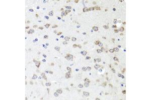 Immunohistochemistry of paraffin-embedded mouse brain using IGFBP5 antibody (ABIN6130485, ABIN6142257, ABIN6142259 and ABIN6216084) at dilution of 1:100 (40x lens). (IGFBP5 抗体  (AA 68-167))