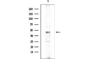 Western blot analysis of lysates from Rat brain, using MCM9 Antibody at 1/1000 dilution.