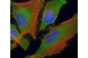 Immunofluorescent staining of permeabilized human HeLa cells with ASS1 antibody at 1:25 dilution, followed by Dylight 488-conjugated goat anti-rabbit lgG (green). (ASS1 抗体  (AA 192-221))