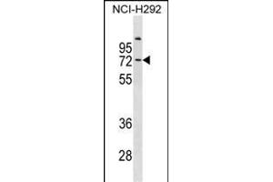 COL9A3 Antibody (Center) (ABIN1881221 and ABIN2838976) western blot analysis in NCI- cell line lysates (35 μg/lane). (COL9A3 抗体  (AA 501-528))