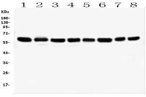 Western blot analysis of HSPD1 using anti-HSPD1 antibody (ABIN7600976). (HSPD1 抗体  (AA 260-496))