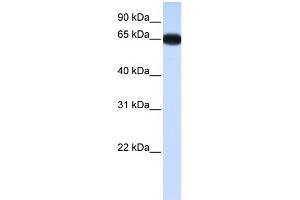 WB Suggested Anti-DLX4 Antibody Titration:  0. (DLX4 抗体  (N-Term))