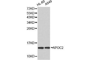 Western blot analysis of extracts of various cell lines, using APOC2 antibody. (Apolipoprotein C-II 抗体  (AA 1-101))