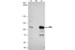 IP Image NBS1 antibody immunoprecipitates nibrin protein in IP experiments. (Nibrin 抗体)