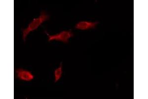 ABIN6276160 staining HeLa by IF/ICC. (OR4X1 抗体  (C-Term))