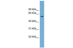 IFI44 antibody used at 1 ug/ml to detect target protein. (IFI44 抗体  (Middle Region))