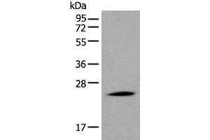 Western blot analysis of Human liver tissue lysate using APOD Polyclonal Antibody at dilution of 1:550 (Apolipoprotein D 抗体)