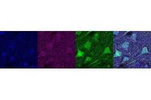 Immunohistochemistry (IHC) image for anti-Ubiquitin Carboxyl-terminal Esterase L1 (Ubiquitin Thiolesterase) (UCHL1) antibody (ABIN7456167) (UCHL1 抗体)