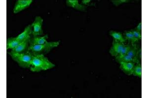 Immunofluorescent analysis of Hela cells using ABIN7154436 at dilution of 1:100 and Alexa Fluor 488-congugated AffiniPure Goat Anti-Rabbit IgG(H+L) (GAB2 抗体  (AA 273-484))